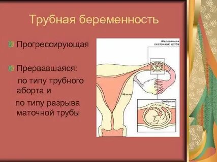 Причины разрыва труб