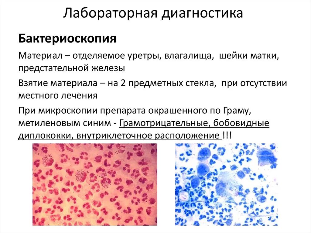 Гонококки хламидии. Хламидии лабораторная диагностика. Хламидии люминесцентная микроскопия. Возбудитель хламидии микробиология. Микроскопический метод диагностики гонореи.