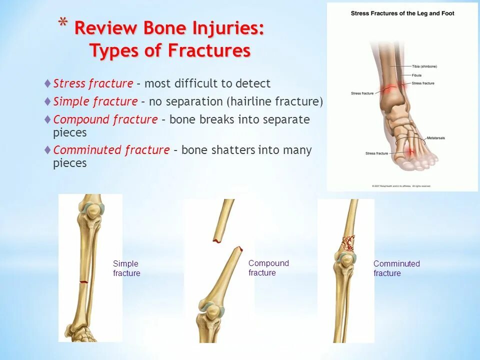 Bone Joint muscle injuries.