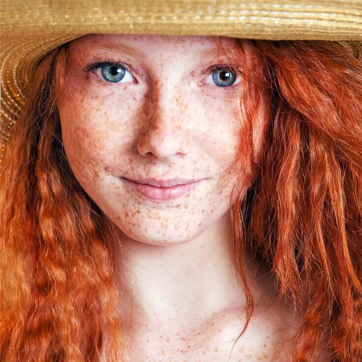 Freckles girl