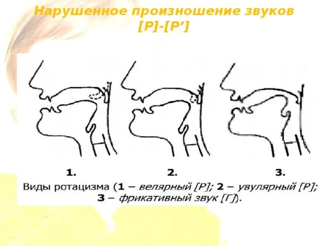 Произношение отдельных звуков. Как выговаривать звук р. Неправильное произношение звука р. Правильное произношение звука р. Правильное произношение буквы р.