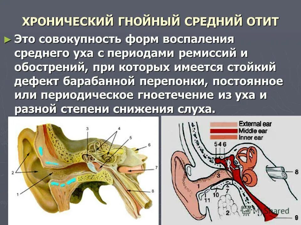 Функции барабанной перепонки. Порванная барабанная перепонка. Гнойный отит и мастоидит. Симптомы повреждения барабанной перепонки. Первая помощь при травме уха.