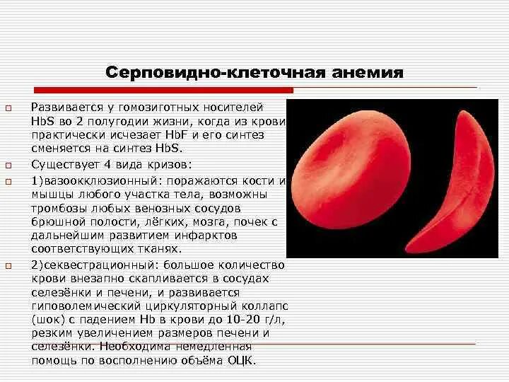 Серповидноклеточная анемия формы. Синдром при серповидноклеточной анемии. Серповидноклеточная анемия этиология. Серповидно клеточная анемия картина крови. Серповидноклеточная анемия клиническая картина.