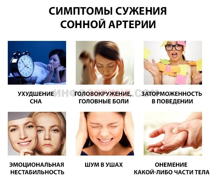 Сосуд в голове сузился. Сужение сосудов симптомы. Ангиодистония артерий головного мозга. Сужение артерий головного мозга. Сокращение сосудов головного мозга.