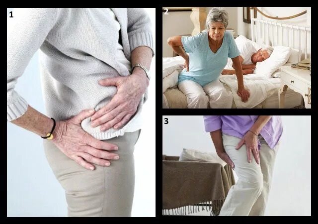 Остеоартроз тазобедренного 2 степени. Утренняя скованность суставов. Заболевания тазобедренного сустава у женщин.
