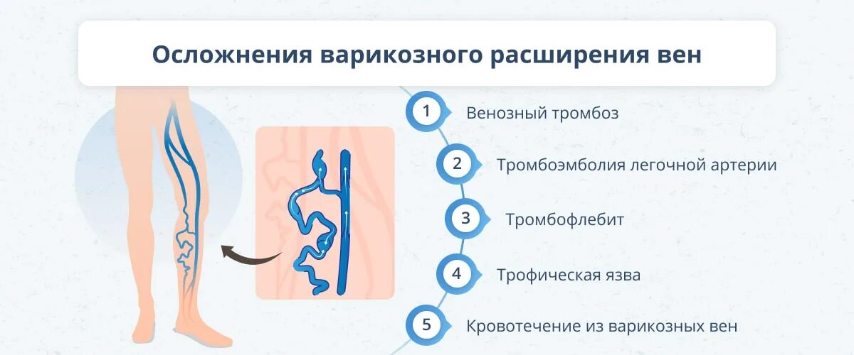 Варикозное расширение вен нижних конечностей осложнения. Варикозное расширение вен (ВРВ) нижних конечностей. Осложнения варикозной болезни вен нижних конечностей. Варикозное расширение вен схема. Что значит расширение вен