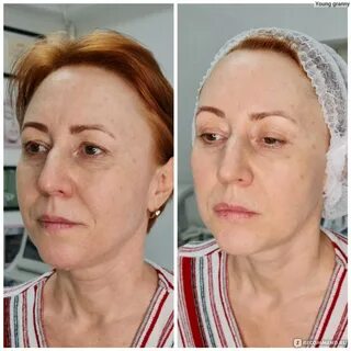Смас плюсы и минусы