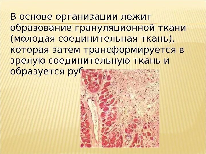 Жила лежит в основе. Образование грануляционной ткани. Молодая соединительная ткань. Грануляционная соединительная ткань. Молодая грануляционная ткань.