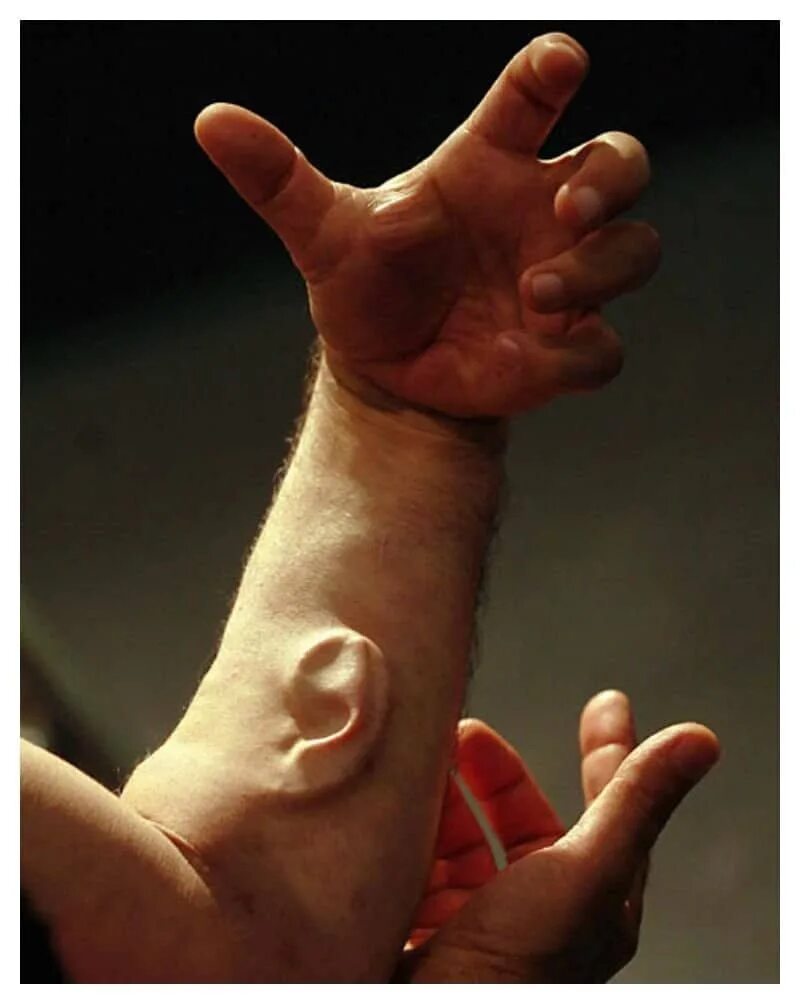 Перепонки между пальцами у мужчин. Австралийский художник Стеларк.. Перепонки на руках у человека.