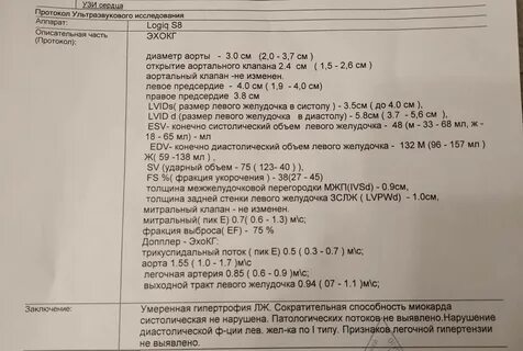 Узи сердца что показывает стоит ли делать