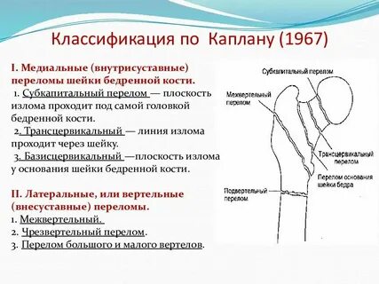 Тест нмо переломы проксимального