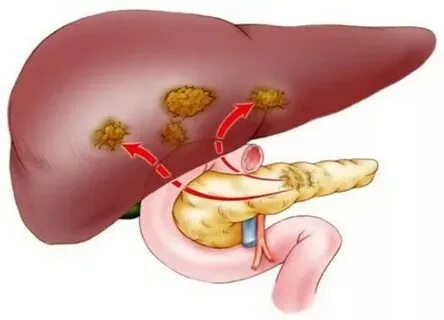 Порнодағы мойынсұнғыш жетілген