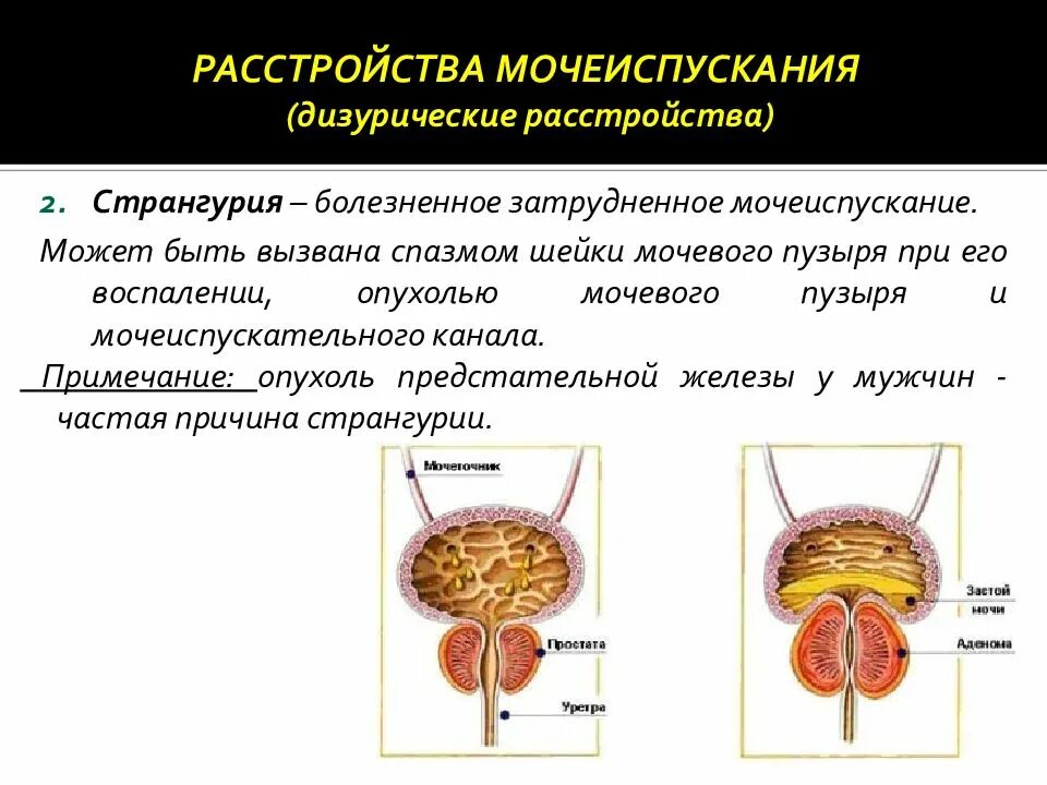 Расстройство мочеиспускания латынь. Расстройства мочеиспускания дизурические расстройства. Нарушение мочевыделения. Причины нарушения мочевыделения. Затрудненное болезненное мочеиспускание.