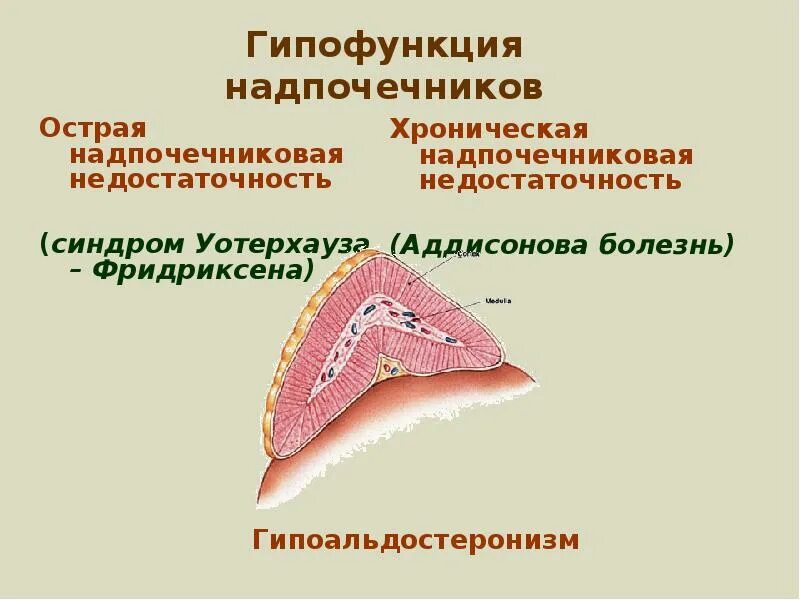 Гипофункция коркового вещества надпочечников. Недостаточность коры надпочечников бронзовая болезнь. Гипофункция мозгового вещества надпочечников. Гипофункция мозгового слоя надпочечников. Гиперфункция мозгового вещества надпочечников