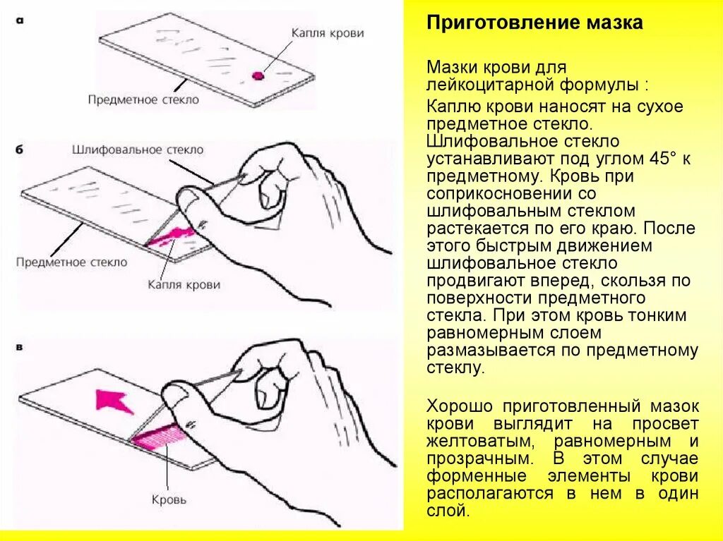 Для чего нужно предметное стекло. Методика приготовления тонкого мазка крови. Приготовление мазка крови алгоритм. Техника приготовления мазка на предметном стекле. Мазок из толстой капли крови алгоритм.