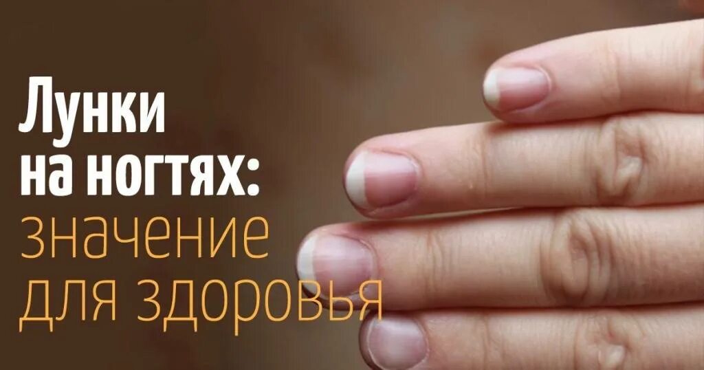 Что значит ногтях. Лунки на ногтях заболевания. лунки на ногтях здорового человека.