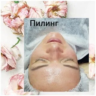 Время пилингов