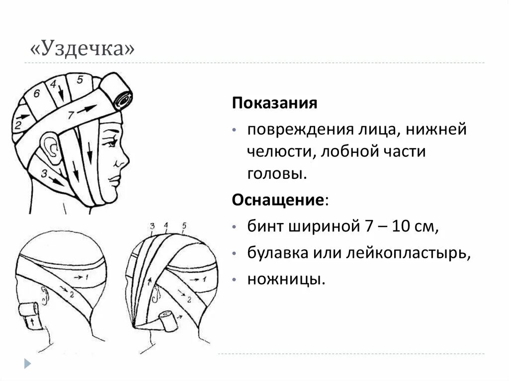 Уздечка алгоритм наложения. Наложение повязки уздечка алгоритм. бинтовая повязка уздечка. техника наложения повязок на голову уздечка. уздечка повязка алгоритм наложение повязки.