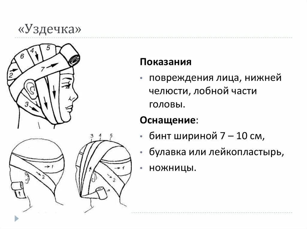 Повязка на голову размеры. Повязка уздечка. Наложение повязки уздечка. Наложение повязки на голову уздечка. Уздечка десмургия.