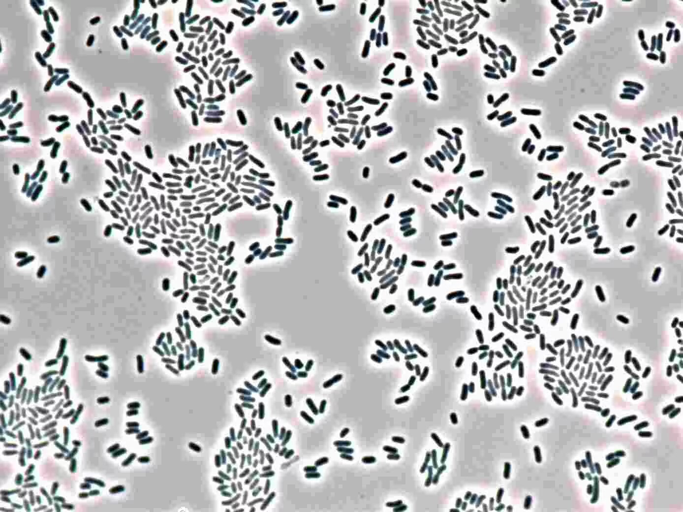 Условно патогенные энтеробактерии микробиология. Бактерии семейства enterobacteriaceae. Pseudomonas aeruginosa пневмония. Энтеробактер cloacae. Enterobacter spp.