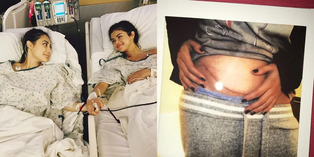 болезнь селены гомес. волчанка у селены гомес. болезнь селены гомес. болезнь селены гомес. волчанка у селены гомес.