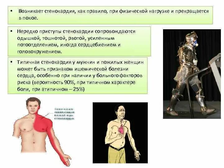 Что такое стенокардия и как. Физическая нагрузка при стенокардии. стенокардия возникает. типичная стенокардия. вынужденное положение при стенокардии.