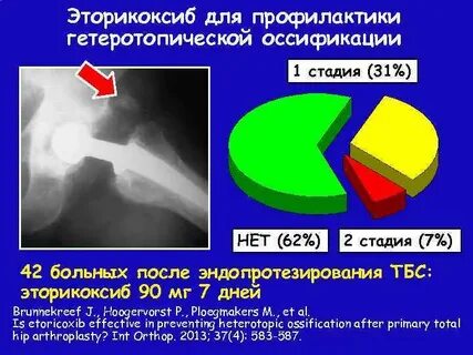 Оссификация это