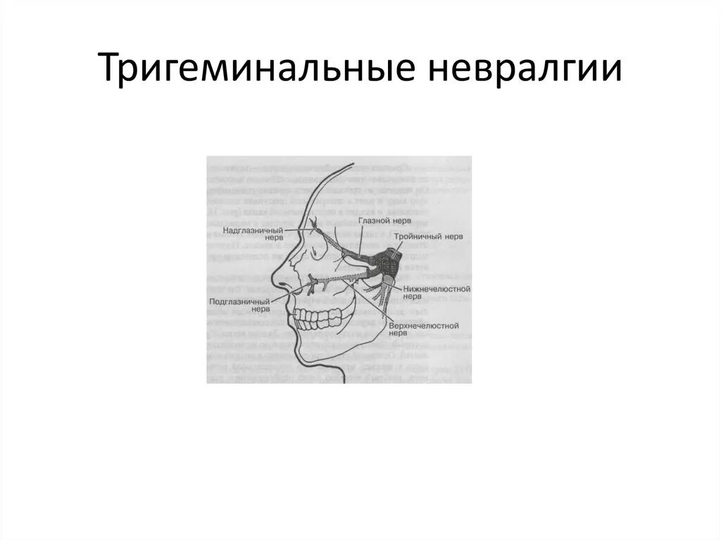 Лечение тройничного лицевого нерва в домашних. Терапия невралгии тройничного нерва. Внутриротовая блокада тройничного нерва. Невралгия ушного узла тройничного нерва. Невралгия 2 ветви тройничного нерва.