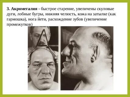 Рост лица