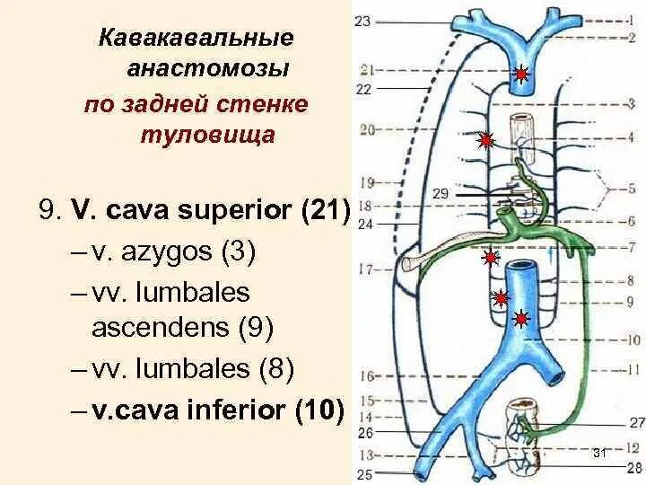 Значение кава кавальных анастомозов. Порто-кава-кавальный анастомоз схема. портокавальные и кавакавальные анастомозы анатомия. порто кавальные и кава кавальные анастомозы анатомия. задний кава кавальный анастомоз.