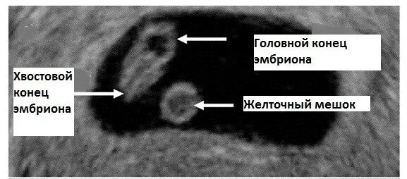 Плодное яйцо желточный мешочек. Желточный мешок на узи норма. желточный мешок и эмбрион на узи. плодное яйцо и желточный мешочек.