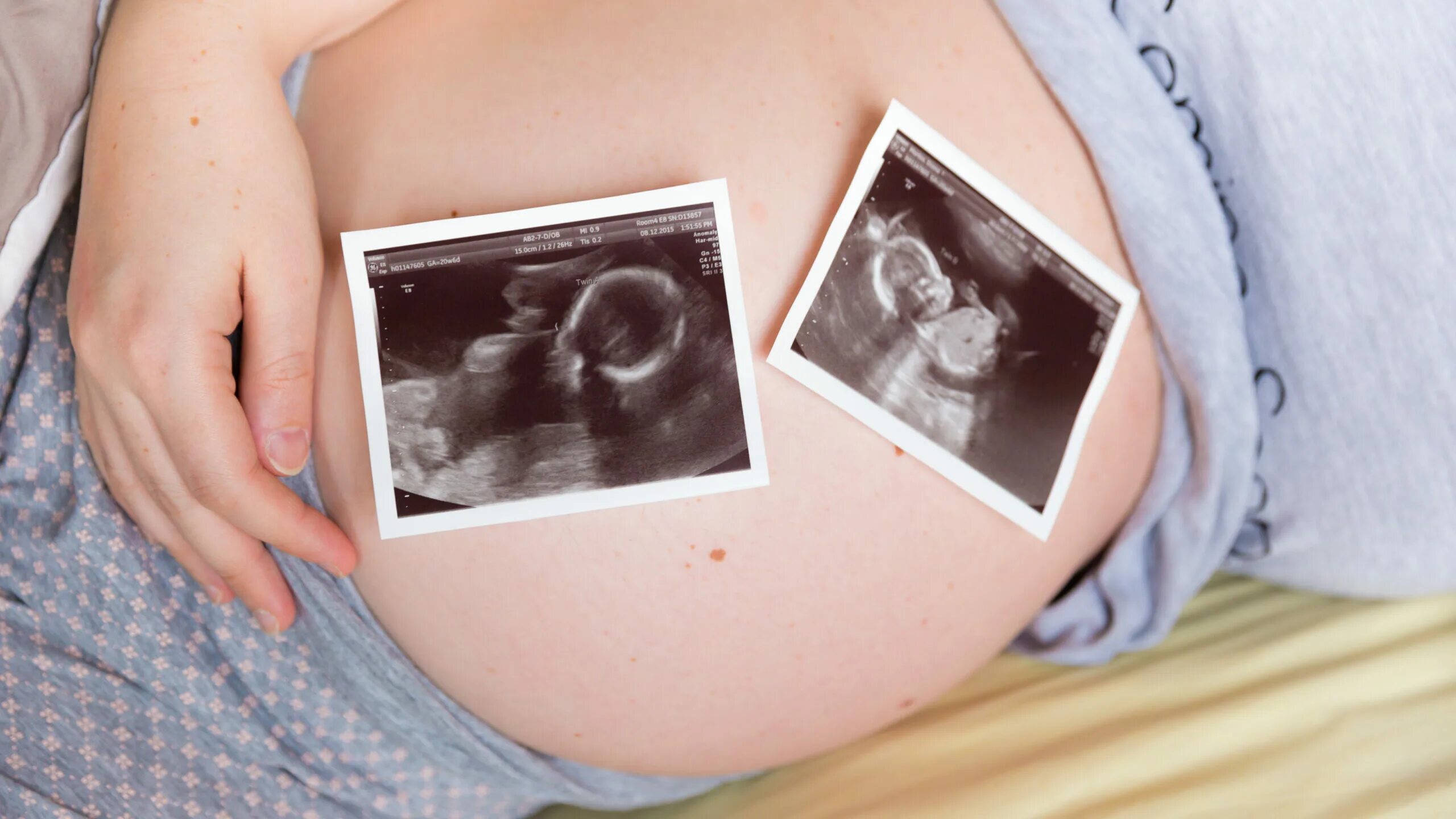 Беременна 2 месяц. Беременность двойней УЗИ.