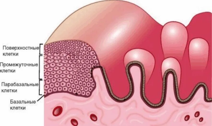 Многослойный плоский эпителий шейки. Многослойный плоский эпителий шейки матки. Слои многослойного плоского эпителия шейки матки. Структура эпителия шейки матки. Эндометрий базальный слой