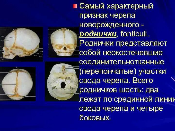 Срединная линия свода черепа. Свод костей черепа новорожденного. Роднички черепа. Формы свода черепа.