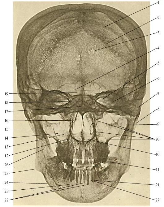 Задняя проекция черепа. Задняя проекция черепа. Рентгеноанатомия костей черепа. Ппн в носоподбородочной проекции. Полуаксиальная проекция черепа.