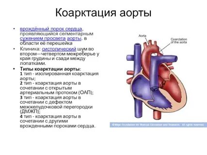 Как сделать впс
