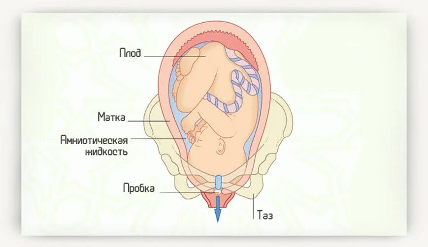 Излитие околоплодных вод период родов. Отошла пробка при родах. Слизистая пробка при беременности. Через сколько начинаются роды после прокола пузыря