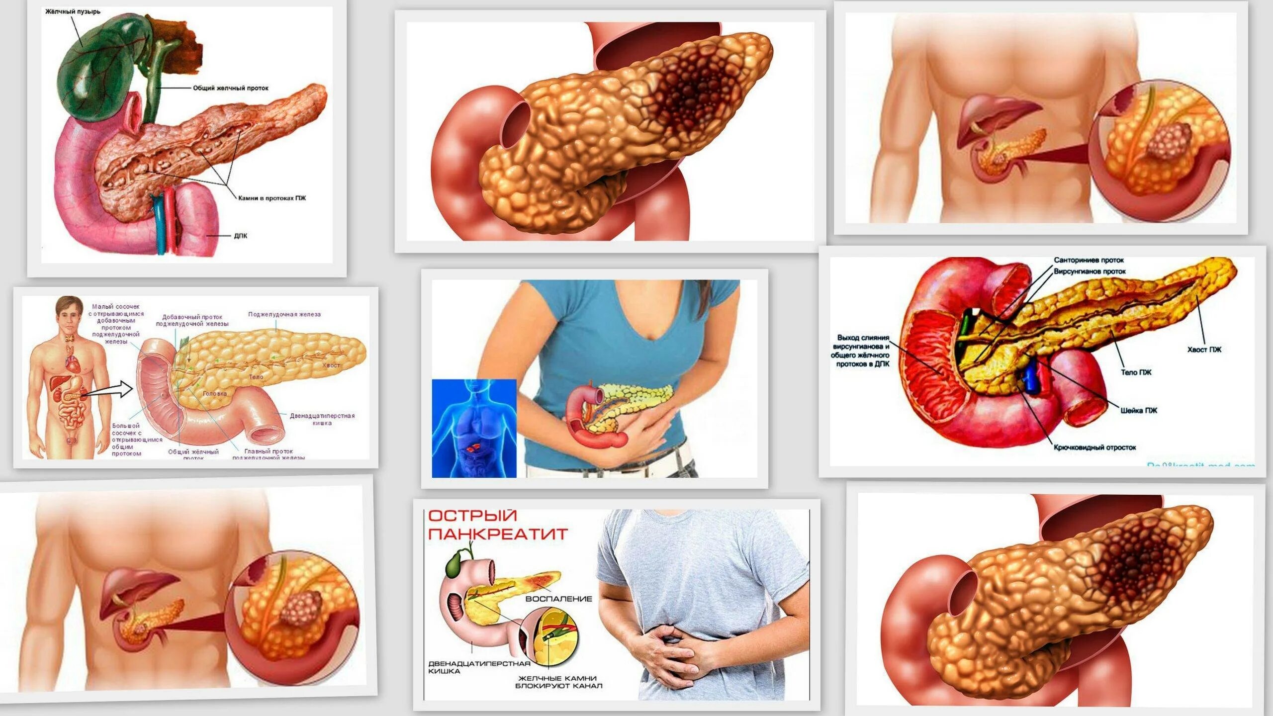 Поджелудочная железа острые боли. Патология поджелудочной железы панкреатит. Симптомы панкреатита поджелудочной железы. Панкреатит симптомы панкреатин. Поджелудочная железа болезни симптомы заболевания у женщин.