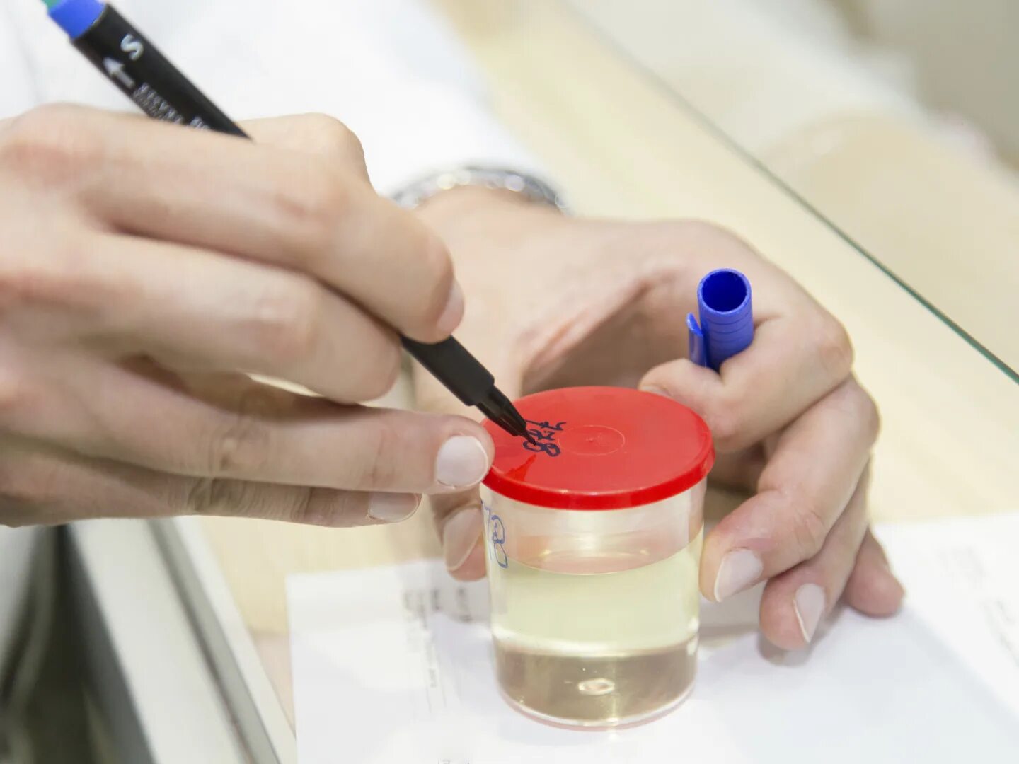 Биоматериал для биохимических исследований. Лабораторный анализ мокроты. Схема исследования на дисбактериоз кишечника. Подготовка биологического материала к исследованию. Подготовка биоматериала к бактериологическому исследованию.