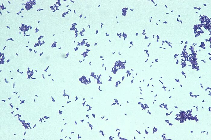 Peptostreptococcus. Arcanobacterium haemolyticum. Corynebacterium SPP микроскопом. Пептострептококки микробиология. Rhodococcus erythropolis морфология.