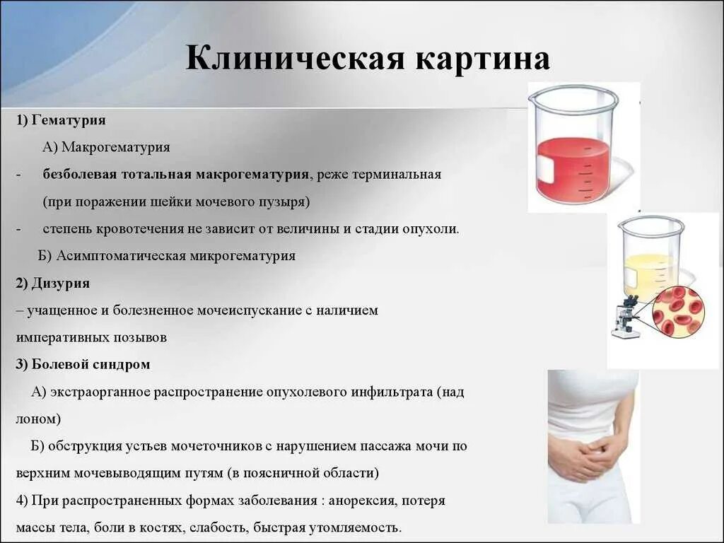 Красная моча лечение