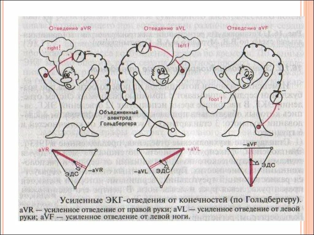 Avr отведение экг. Усиленные однополюсные отведения экг. отведения экг по гольдбергеру. усиленные однополюсные отведения от конечностей. отведения экг физиология.
