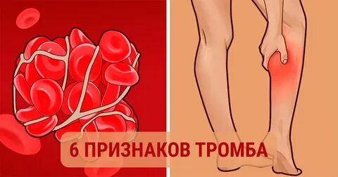 Проверка на тромбы во всем организме