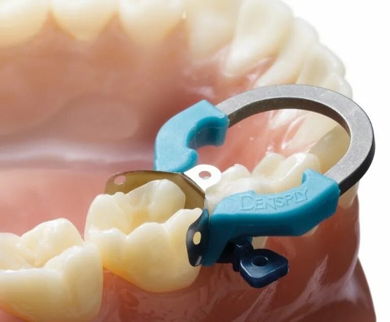 матрицы palodent v3. матричные системы в стоматологии. матричные системы в стоматологии. матрица для зубов для пломбирования. матричные системы в стоматологии.