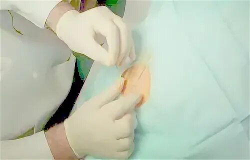Кодирование торпедо spv clinic