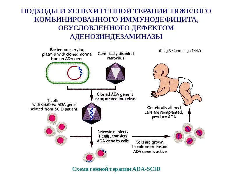 Генная терапия заболеваний. Генная терапия тяжелого комбинированного иммунодефицита. Дефицит аденозиндезаминазы патогенез. Подходы генной терапии. Схема проведения генной терапии.