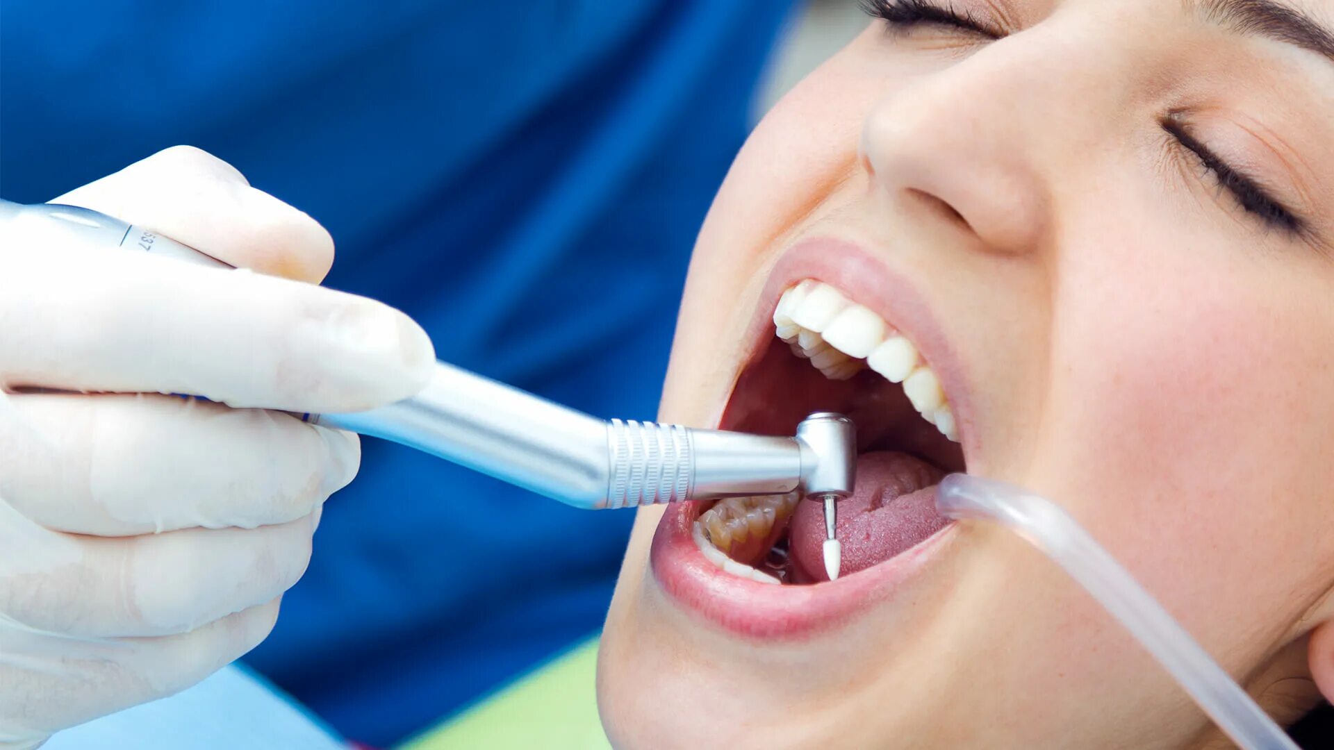 Профессиональная гигиена полости рта. Зубы стоматология. Можно вылечить зубы разом