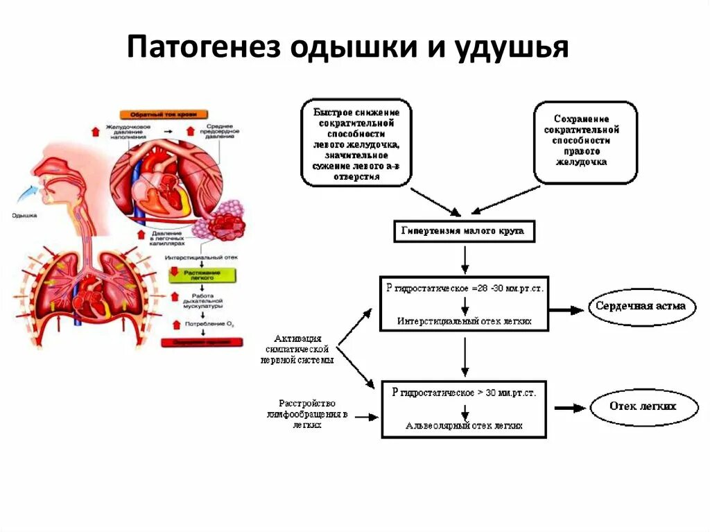 Механизм развития одышки при дыхательной недостаточности. Одышка механизм развития при заболевании сердца. Патогенез сердечно-сосудистой недостаточности. Механизм развития одышки патофизиология. Дыхание при сердечной недостаточности