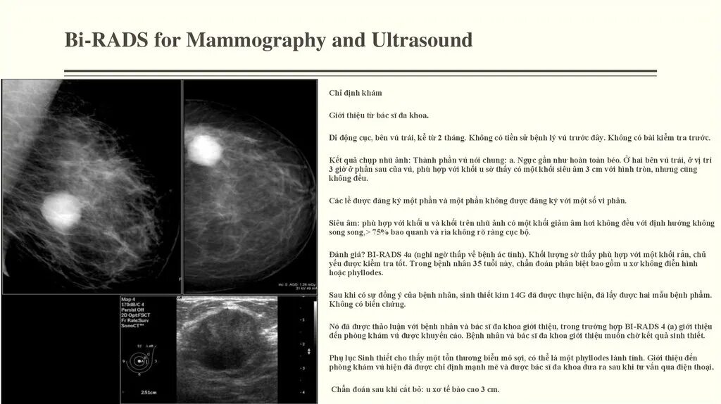 Маммография birads 4. Классификация молочной железы bi rads. Классификация bi-rads для УЗИ. Bi rads 5 на маммографии. Rads r