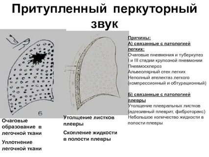 Уплотнения паренхимы